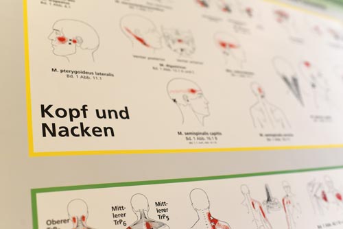 Triggerpunkttherapie